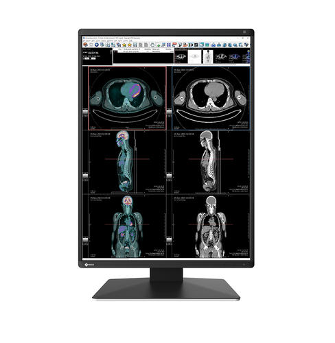 EIZO RadiForce RX370 21.3-inch medical LCD monitor with 1536 x 2048 resolution in black for diagnostic imaging