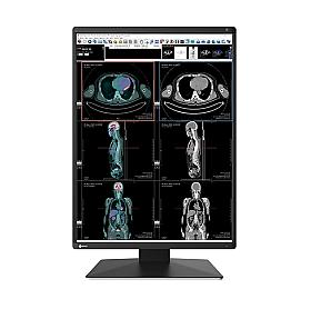 EIZO RadiForce RX370 21.3-inch medical LCD monitor with 1536 x 2048 resolution in black for diagnostic imaging